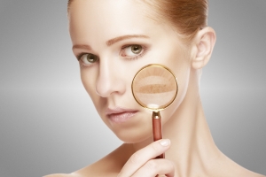 acné en adultos, ¿Sabías que el acné en mujeres adultas es más común de lo que se cree?, Cliniderma 🥇