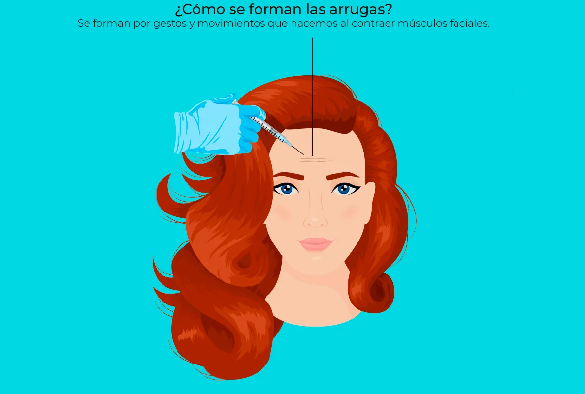 mitos toxina botulínica