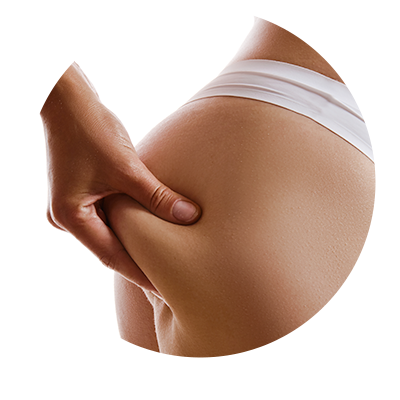, Natural Butt Fit, Cliniderma