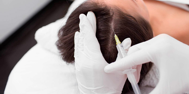 Caída de pelo, Tratamiento para la caída de pelo (Alopecia), Cliniderma 🥇