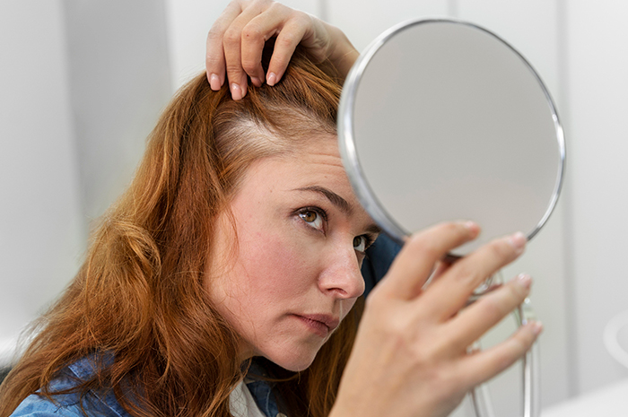 Tratamiento para la caída del pelo, Tratamiento para la caída del pelo (Alopecia), Cliniderma