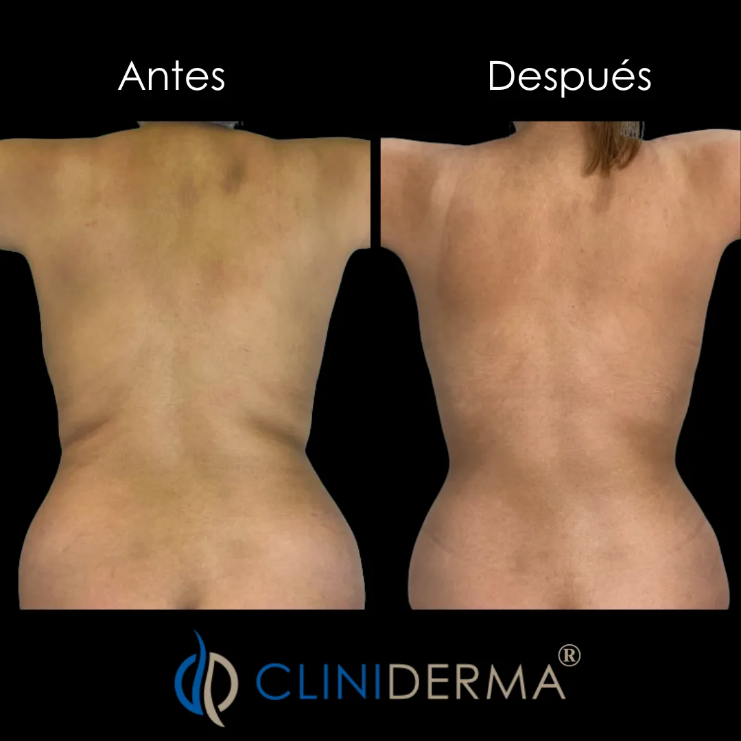estetica corporal