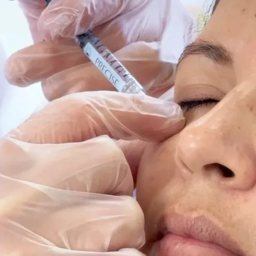 periocular tratamiento